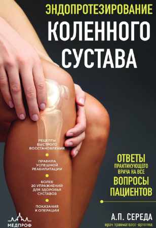Эндопротезирование коленного сустава