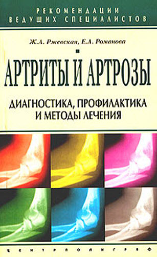 Ж. Ржевская, Е. Романова. Артриты и артрозы. Диагностика, профилактика и методы лечения